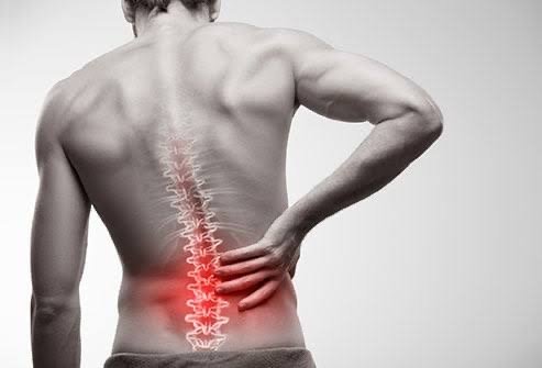 Back Pain (4)
