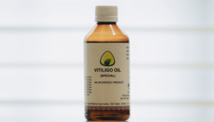 Vitiligo Oil