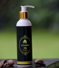 vitiligo oil