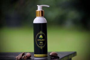 vitiligo oil