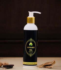vitiligo oil