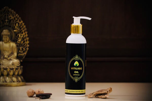 vitiligo oil