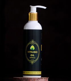 vitiligo oil