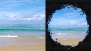 Retinitis Pigmentosa