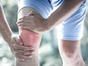 Gouty Arthritis