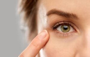 Macular degeneration